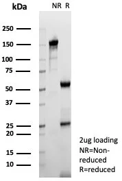 SDS-PAGE Analysis of Purified TPH1 Mouse Monoclonal Antibody (TPH1/7661). Confirmation of Purity and Integrity of Antibody.