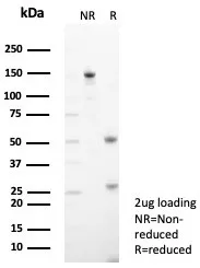 SDS-PAGE Analysis of Purified TPH1 Mouse Monoclonal Antibody (TPH1/7662). Confirmation of Purity and Integrity of Antibody.