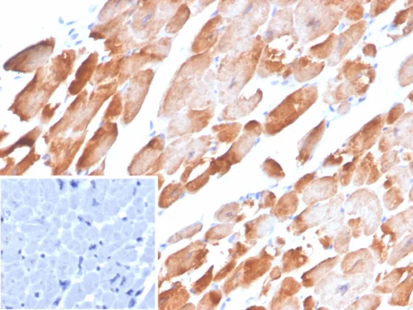 Formalin-fixed, paraffin-embedded human heart stained with Tropomyosin Mouse Monoclonal Antibody (TPM1/4510). Inset: PBS instead of primary antibody; secondary only negative control.