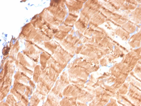 Formalin-fixed, paraffin-embedded human skeletal muscle stained with Tropomyosin Mouse Monoclonal Antibody (TPM1/4510). HIER: Tris/EDTA, pH9.0, 45min. 2°C: HRP-polymer, 30min. DAB, 5min.