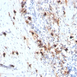 Formalin-fixed, paraffin-embedded human tonsil stained with Tryptase Recombinant Mouse Monoclonal Antibody (rTPSAB1/1963). HIER: Tris/EDTA, pH9.0, 45min. 2°C: HRP-polymer, 30min. DAB, 5min.