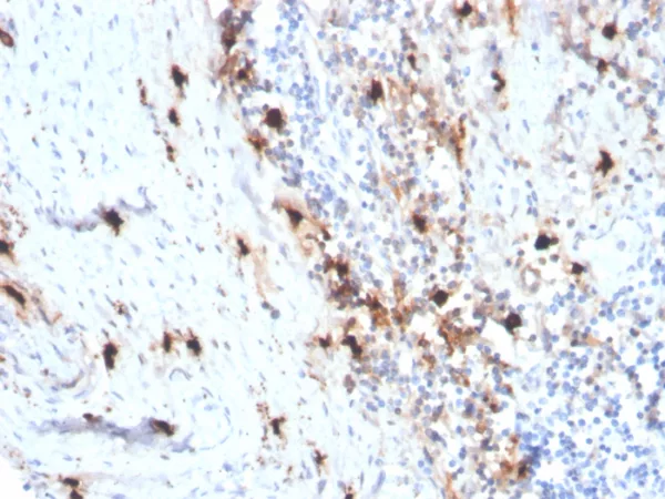 Formalin-fixed, paraffin-embedded human tonsil stained with Tryptase Recombinant Mouse Monoclonal Antibody (rTPSAB1/1963). HIER: Tris/EDTA, pH9.0, 45min. 2°C: HRP-polymer, 30min. DAB, 5min.