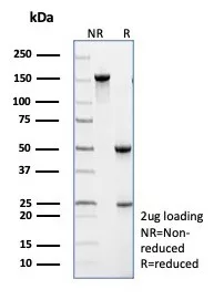 SDS-PAGE Analysis TRAF1 Mouse Monoclonal Antibody (TRAF1/3299). Confirmation of Purity and Integrity of Antibody.