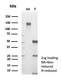 SDS-PAGE Analysis of Purified TRAF1 Mouse Monoclonal Antibody (TRAF1/3365). Confirmation of Purity and Integrity of Antibody.