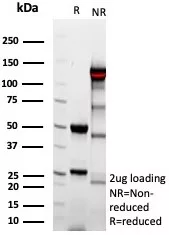 SDS-PAGE Analysis of Purified Complement 4d Mouse Monoclonal Antibody (C4D/9213R). Confirmation of Integrity and Purity of Antibody.