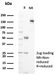 SDS-PAGE Analysis of Purified TRPC6 Mouse Monoclonal Antibody (TRPC6/7671). Confirmation of Purity and Integrity of Antibody.