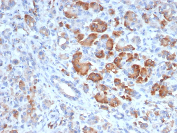 Formalin-fixed, paraffin-embedded human pancreas stained with TRPC6 Mouse Monoclonal Antibody (TRPC6/7672). HIER: Tris/EDTA, pH9.0, 45min. 2°C: HRP-polymer, 30min. DAB, 5min.