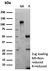 SDS-PAGE Analysis  Purified TSHRB Recombinant Rabbit Monoclonal Antibody (TSHRB/9215R). Confirmation of Purity and Integrity of Antibody.