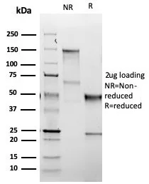 SDS-PAGE Analysis  Purified TSHRB Recombinant Rabbit Monoclonal Antibody (TSHRB/1607R). Confirmation of Purity and Integrity of Antibody.
