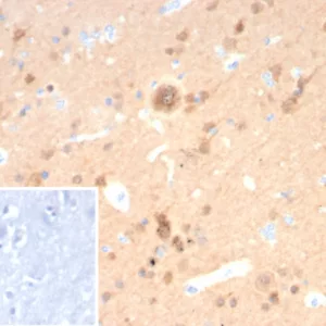 Formalin-fixed, paraffin-embedded human cerebellum stained with Pgp9.5 Mouse Recombinant Monoclonal Antibody (rUCHL1/8057). Inset: PBS instead of primary antibody; secondary only negative control.
