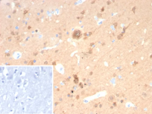 Formalin-fixed, paraffin-embedded human cerebellum stained with Pgp9.5 Mouse Recombinant Monoclonal Antibody (rUCHL1/8057). Inset: PBS instead of primary antibody; secondary only negative control.
