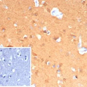 Formalin-fixed, paraffin-embedded human cerebellum stained with Pgp9.5 Mouse Recombinant Monoclonal Antibody (rUCHL1/8133). Inset: PBS instead of primary antibody; secondary only negative control.