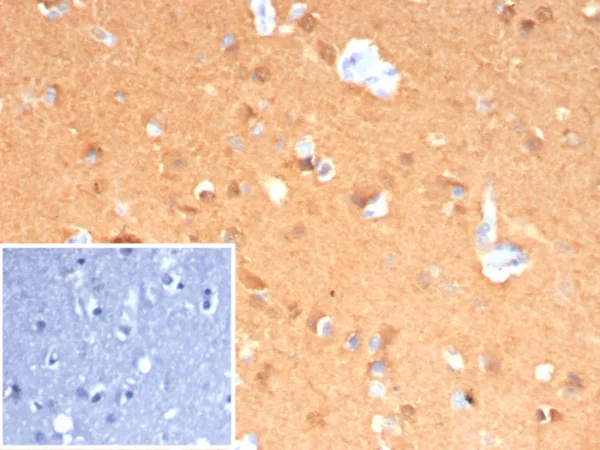 Formalin-fixed, paraffin-embedded human cerebellum stained with Pgp9.5 Mouse Recombinant Monoclonal Antibody (rUCHL1/8133). Inset: PBS instead of primary antibody; secondary only negative control.