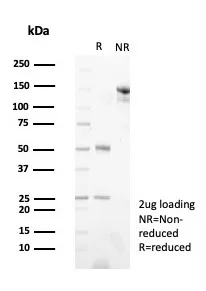 SDS-PAGE Analysis of Purified Pgp9.5 Mouse Monoclonal Antibody (UCHL1/8152). Confirmation of Purity and Integrity of Antibody.