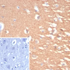 ormalin-fixed, paraffin-embedded human cerebellum stained with Pgp9.5 Rabbit Recombinant Monoclonal Antibody (UCHL1/7076R). Inset: PBS instead of primary antibody; secondary only negative control