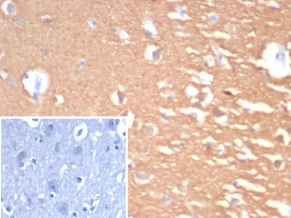 ormalin-fixed, paraffin-embedded human cerebellum stained with Pgp9.5 Rabbit Recombinant Monoclonal Antibody (UCHL1/7076R). Inset: PBS instead of primary antibody; secondary only negative control