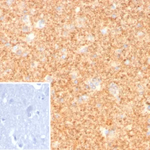 Formalin-fixed, paraffin-embedded human cerebellum stained with Pgp9.5 Rabbit Recombinant Monoclonal Antibody (UCHL1/8107R). Inset: PBS instead of primary antibody; secondary only negative control.
