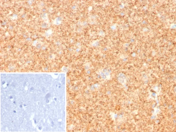 Formalin-fixed, paraffin-embedded human cerebellum stained with Pgp9.5 Rabbit Recombinant Monoclonal Antibody (UCHL1/8107R). Inset: PBS instead of primary antibody; secondary only negative control.