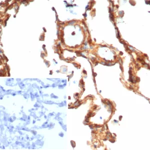 Formalin-fixed, paraffin-embedded human lung stained with Vinculin Recombinant Mouse Monoclonal Antibody (rVCL/7287). Inset: PBS instead of primary antibody; secondary only negative control.