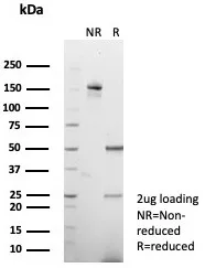 SDS-PAGE Analysis of Purified Vinculin Recombinant Rabbit Monoclonal Antibody (VCL/8533R). Confirmation of Purity and Integrity of Antibody.