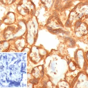 Formalin-fixed, paraffin-embedded human placenta stained with VEGF Recombinant Rabbit Monoclonal Antibody (VEGFA/7757R). Inset: PBS instead of primary antibody; secondary only negative control.