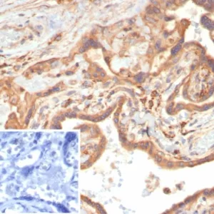 Formalin-fixed, paraffin-embedded human placenta stained with VEGF Recombinant Rabbit Monoclonal Antibody (VEGFA/7758R). Inset: PBS instead of primary antibody; secondary only negative control.