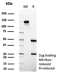 SDS-PAGE Analysis of Purified Villin Recombinant Rabbit Monoclonal Antibody (VIL1/8105R). Confirmation of Purity and Integrity of Antibody.