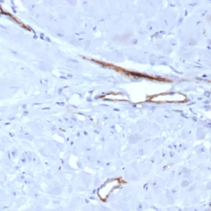 Formalin-fixed, paraffin-embedded human uterus stained with vWF Recombinant Rabbit Monoclonal Antibody (VWF/7979R). HIER: Tris/EDTA, pH9.0, 45min. 2: HRP-polymer, 30min. DAB, 5min.