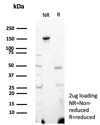 SDS-PAGE Analysis	 Purified WT1 Mouse Monoclonal Antibody (WT1/7451). Confirmation of Integrity and Purity of Antibody.