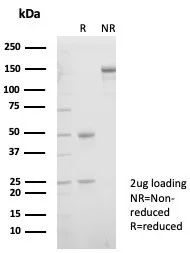 SDS-PAGE Analysis of Purified XRCC5 / Ku86 / Ku80 Mouse Monoclonal Antibody (XRCC5/7312). Confirmation of Purity and Integrity of Antibody.