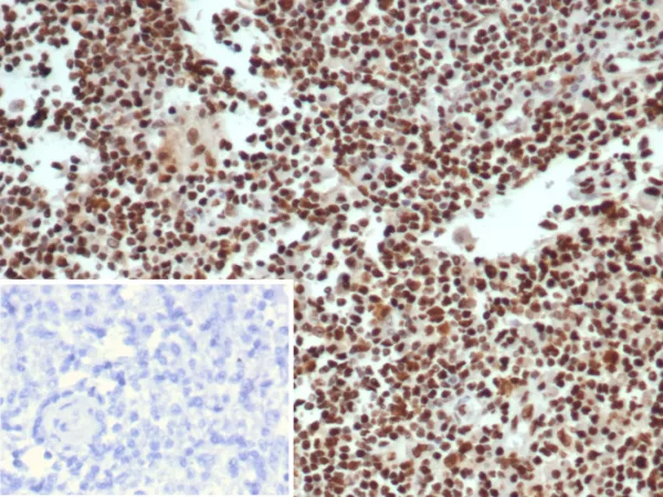 Formalin-fixed, paraffin-embedded human lymph node stained with XRCC5 / Ku86 / Ku80 Mouse Monoclonal Antibody (XRCC5/7312). Inset: PBS instead of primary antibody; secondary only negative control.