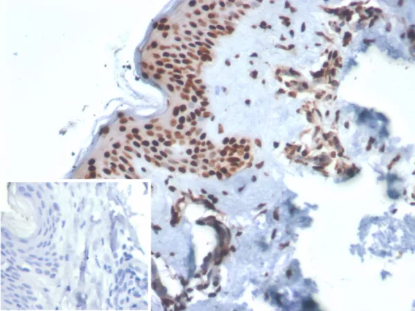 Formalin-fixed, paraffin-embedded human skin stained with XRCC5 / Ku86 / Ku80 Mouse Monoclonal Antibody (XRCC5/7312). Inset: PBS instead of primary antibody; secondary only negative control.