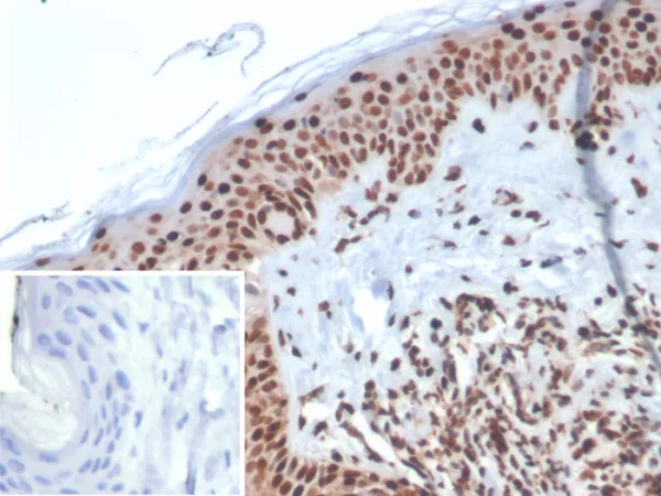 Formalin-fixed, paraffin-embedded human skin stained with XRCC5 / Ku86 / Ku80 Mouse Monoclonal Antibody (XRCC5/7313). Inset: PBS instead of primary antibody; secondary only negative control.