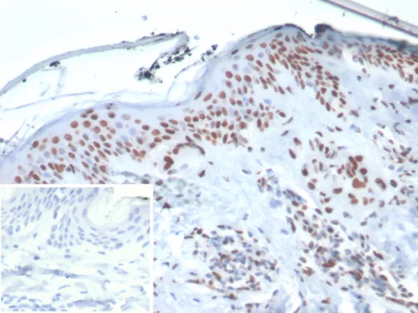 Formalin-fixed, paraffin-embedded human skin stained with XRCC5 / Ku86 / Ku80 Mouse Monoclonal Antibody (XRCC5/7314). Inset: PBS instead of primary antibody; secondary only negative control.
