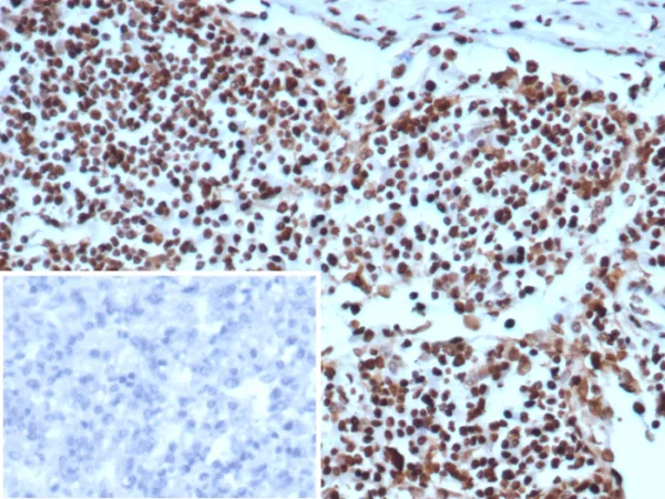 Formalin-fixed, paraffin-embedded human lymph node stained with XRCC5 / Ku86 / Ku80 Mouse Monoclonal Antibody (XRCC5/7314). Inset: PBS instead of primary antibody; secondary only negative control.