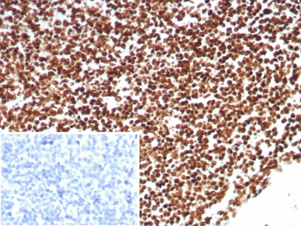 Formalin-fixed, paraffin-embedded human tonsil stained with Ku80 Recombinant Rabbit Monoclonal Antibody (XRCC5/8703R). Inset: PBS instead of primary antibody; secondary only negative control.