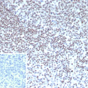 Formalin-fixed, paraffin-embedded human tonsil stained with YY1 Mouse Monoclonal (YY1/5436). Inset: PBS instead of primary antibody; secondary only negative control.