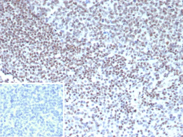 Formalin-fixed, paraffin-embedded human tonsil stained with YY1 Mouse Monoclonal (YY1/5436). Inset: PBS instead of primary antibody; secondary only negative control.