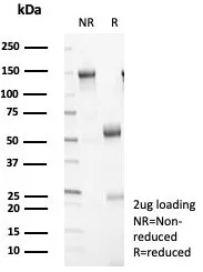 SDS-PAGE Analysis of Purified 14-3-3E Recombinant Rabbit Monoclonal Antibody (YWHAE/8309R). Confirmation of Purity and Integrity of Antibody.