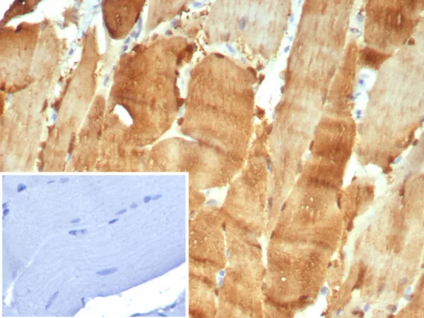 Formalin-fixed, paraffin-embedded human skeletal muscle stained with CA3 Mouse Monoclonal Antibody (CA3/7884). HIER: Tris/EDTA, pH9.0, 45min. 2°C: HRP-polymer, 30min. DAB, 5min.
