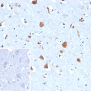 Formalin-fixed, paraffin-embedded human brain stained with CA8 Mouse Monoclonal Antibody (CA8/6814). Inset: PBS instead of primary antibody; secondary only negative control.
