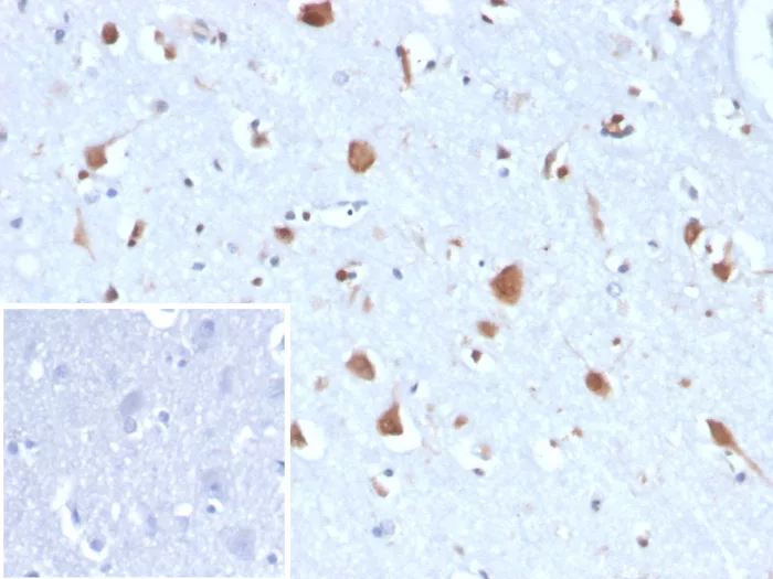 Formalin-fixed, paraffin-embedded human brain stained with CA8 Mouse Monoclonal Antibody (CA8/6814). Inset: PBS instead of primary antibody; secondary only negative control. Carbonic Anhydrase VIII Antibody