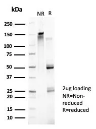 SDS-PAGE Analysis of Purified ZNF157 Mouse Monoclonal Antibody (PCRP-ZNF157-1A8). Confirmation of Purity and Integrity of Antibody.