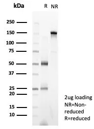 SDS-PAGE Analysis of Purified ZNF232 Mouse Monoclonal Antibody (PCRP-ZNF232-1D5). Confirmation of Purity and Integrity of Antibody.