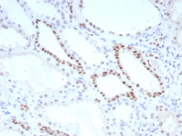 Formalin-fixed, paraffin-embedded human kidney stained with PAX8 Recombinant Rabbit Monoclonal Antibody (PAX8/8651R). HIER: Tris/EDTA, pH9.0, 45min. 2°C: HRP-polymer, 30min. DAB, 5min.