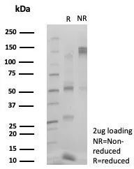 SDS-PAGE Analysis of Purified ZSCAN5A Mouse Monoclonal Antibody (PCRP-ZSCAN5A-2H4). Confirmation of Purity and Integrity of Antibody.