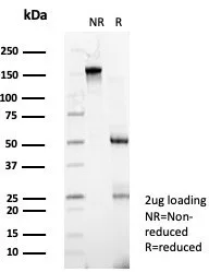 SDS-PAGE Analysis of Purified ZNF343 Mouse Monoclonal Antibody (PCRP-ZNF343-4F8). Confirmation of Purity and Integrity of Antibody.