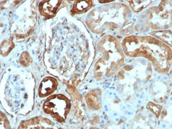 Formalin-fixed, paraffin-embedded human kidney stained with Calbindin 1 Recombinant Mouse Monoclonal Antibody (rCALB1/8499). HIER: Tris/EDTA, pH9.0, 45min. 2°C: HRP-polymer, 30min. DAB, 5min.
