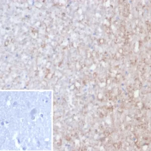 Formalin-fixed, paraffin-embedded human brain stained with Calretinin Recombinant Mouse Monoclonal Antibody (rCALB2/7123). Inset: PBS instead of primary, secondary negative control.