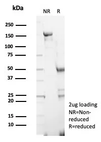 SDS-PAGE Analysis of Purified S100G Mouse Monoclonal Antibody (S100G/7461). Confirmation of Purity and Integrity of Antibody.